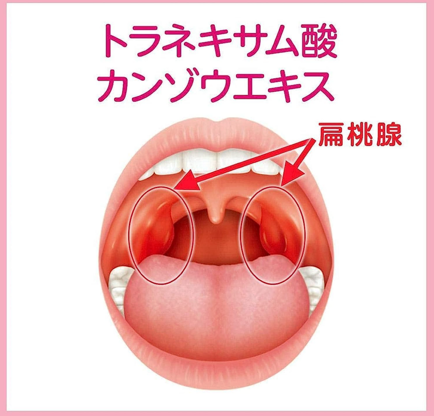 小林製藥 Halenurse 扁桃腺發炎咽喉腫痛藥 9包