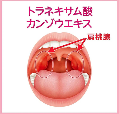 小林製藥 Halenurse 扁桃腺發炎咽喉腫痛藥 9包